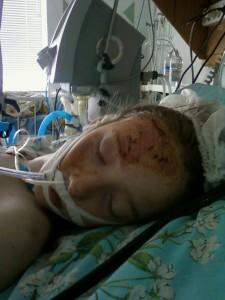 Новости Херсон. Девочка из Каховки в тяжелом состоянии после аварии